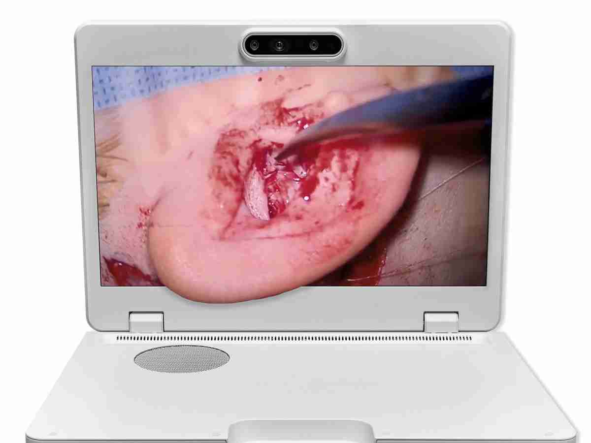 达擎之＂Heads-up 3D显微手术显示系统＂，，整合4K裸眼3D显示及眼球追踪系统，，具备快速追踪人眼移动位置功能，，，，减轻医师长时间维持固定姿势的负担，，，，让医师能有更宽广清晰的3D立体视野及更舒适的姿势来执行手术。。。。